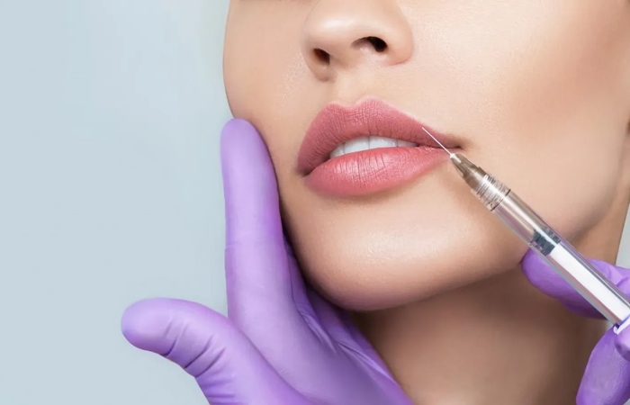 Other Benefits Of Lip Fillers